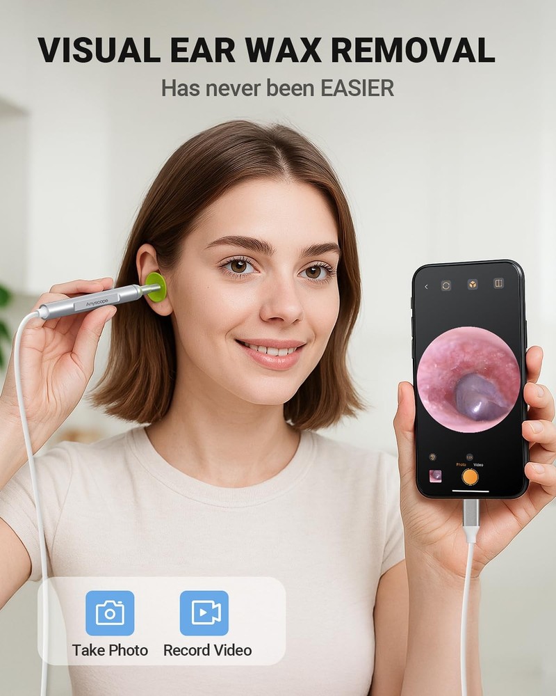 HD Digital Otoscope for iPhone & Android Ear Wax Removal Camera