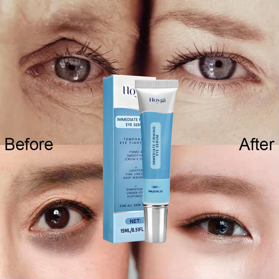 Under Eye Cream Remove Dark Circles Bags Face Lines Ageless Wrinkles Puffy Eye-