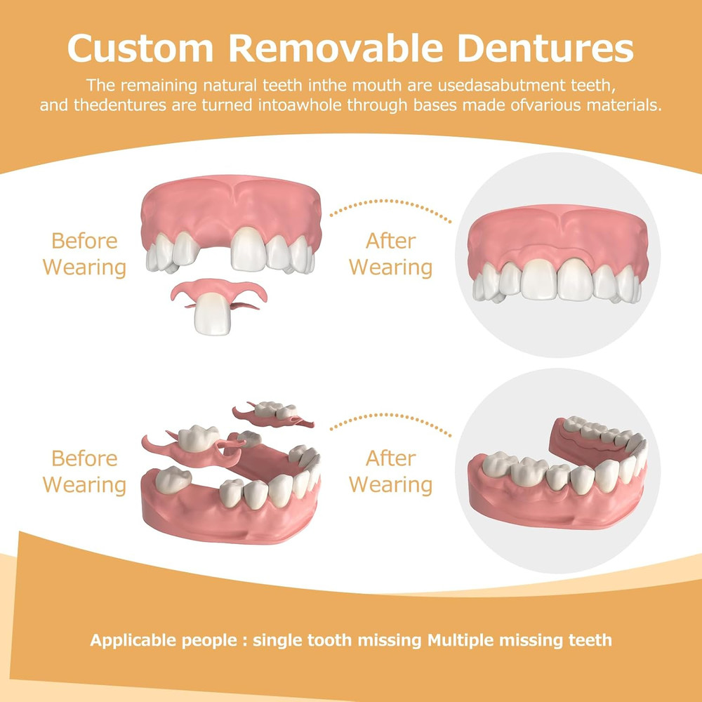 Partial Dentures - Dentures for Missing Teeth & Gaps - Lightweight & Unbreakable
