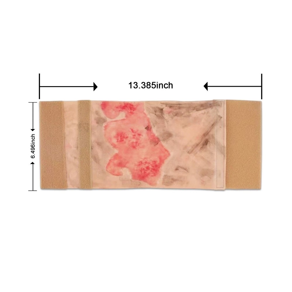 Limbs Burn Training Model, Realistic Wound Simulation Module Simulated Skin
