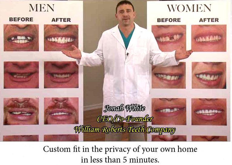 SMALL SIZE INSTANT SMILE BEAUTIFUL PERFECT TEETH 2 PKG BEADS dentures MAKEOVER