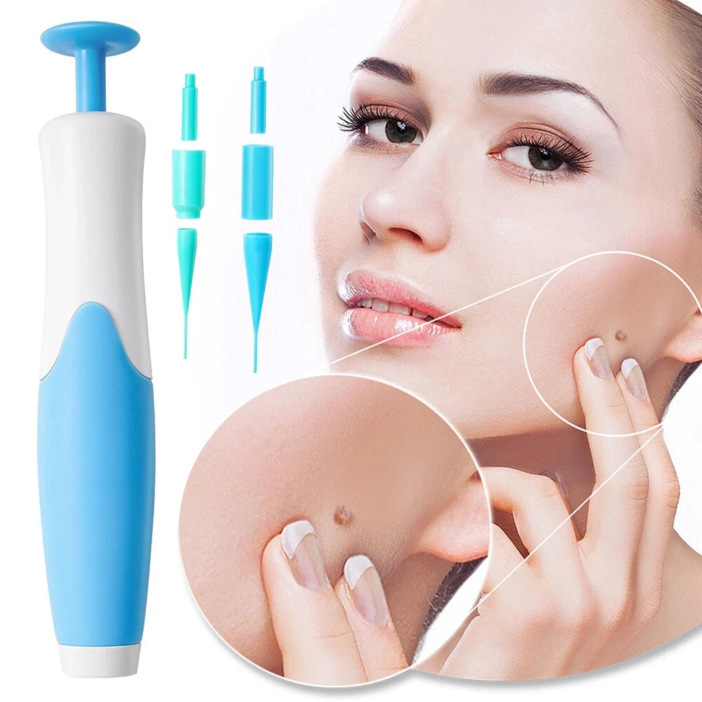 Auto Micro Skin Tag Remover Device Kit Safe Painless Removal 2-8 mm Band Tool
