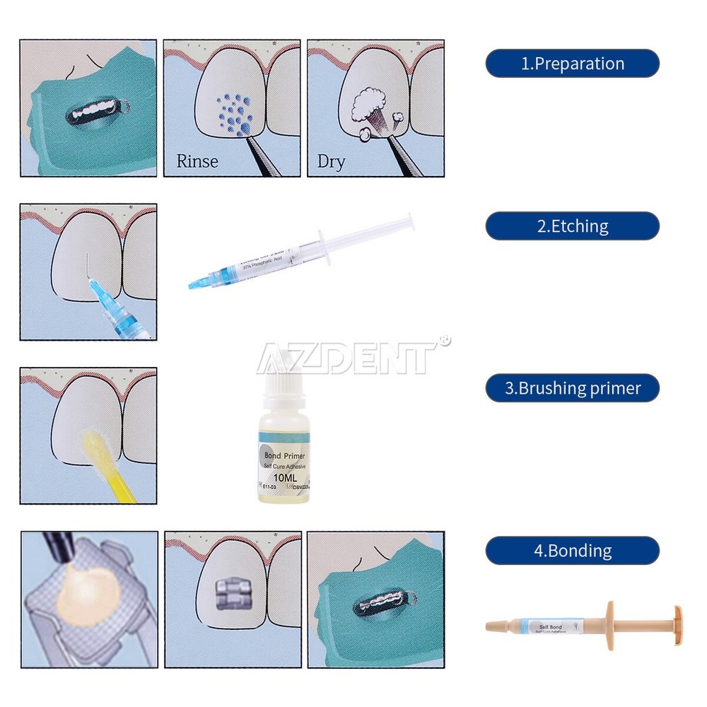 Dental Orthodontic Brackets Light Cure Bonding Adhesive Etch Gel Bonding System