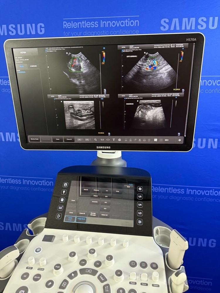 Samsung HS70A Ultrasound system