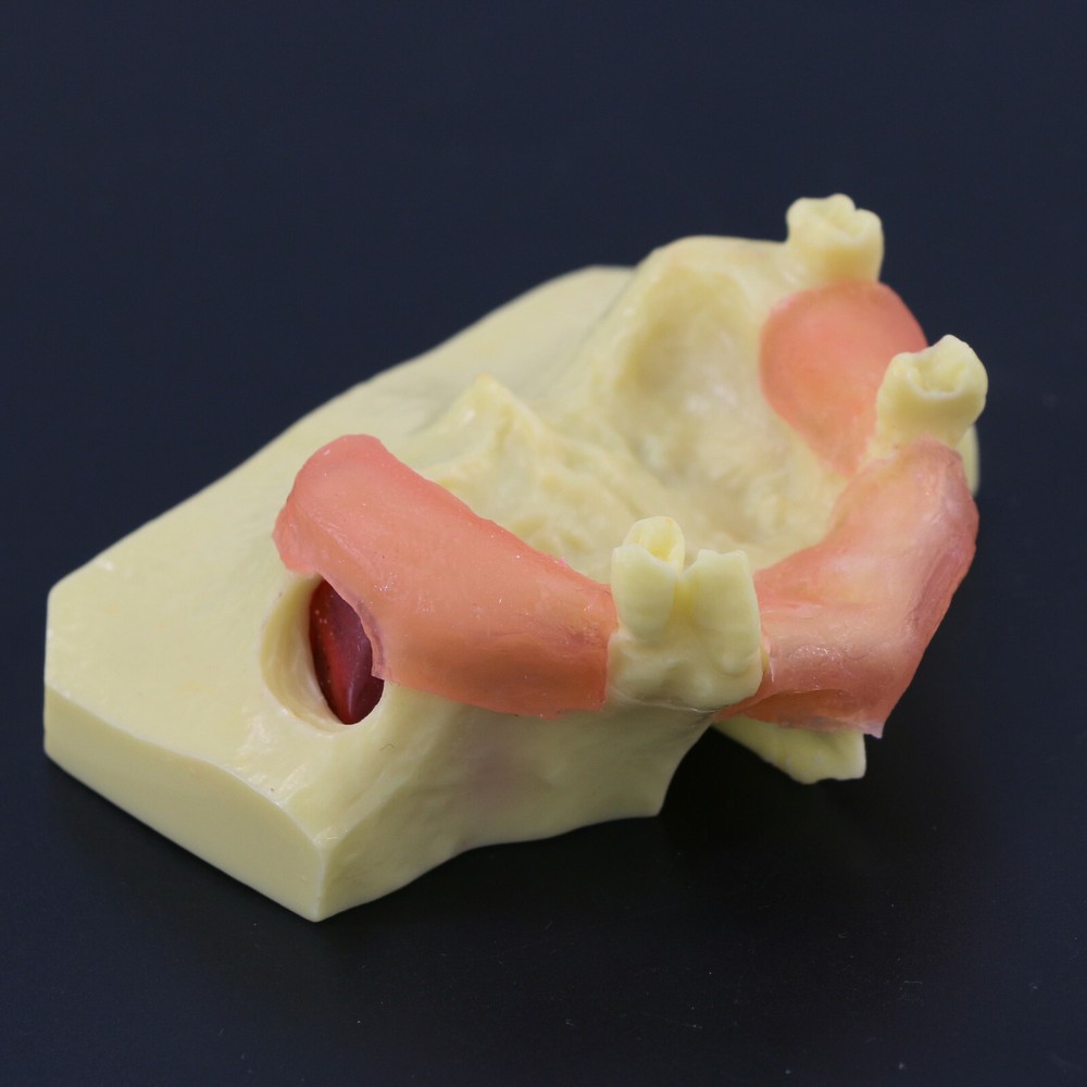 Dental Typodont Teeth Model Sinus Lift Practice Study Teach Demo Model 2012 2013