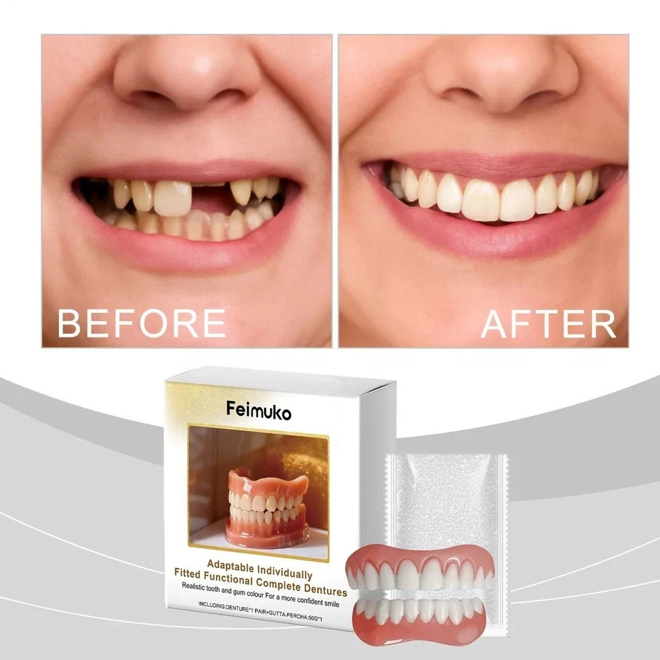 Full Denture Set Upper Lower False Teeth for Men Women Dental Replacement