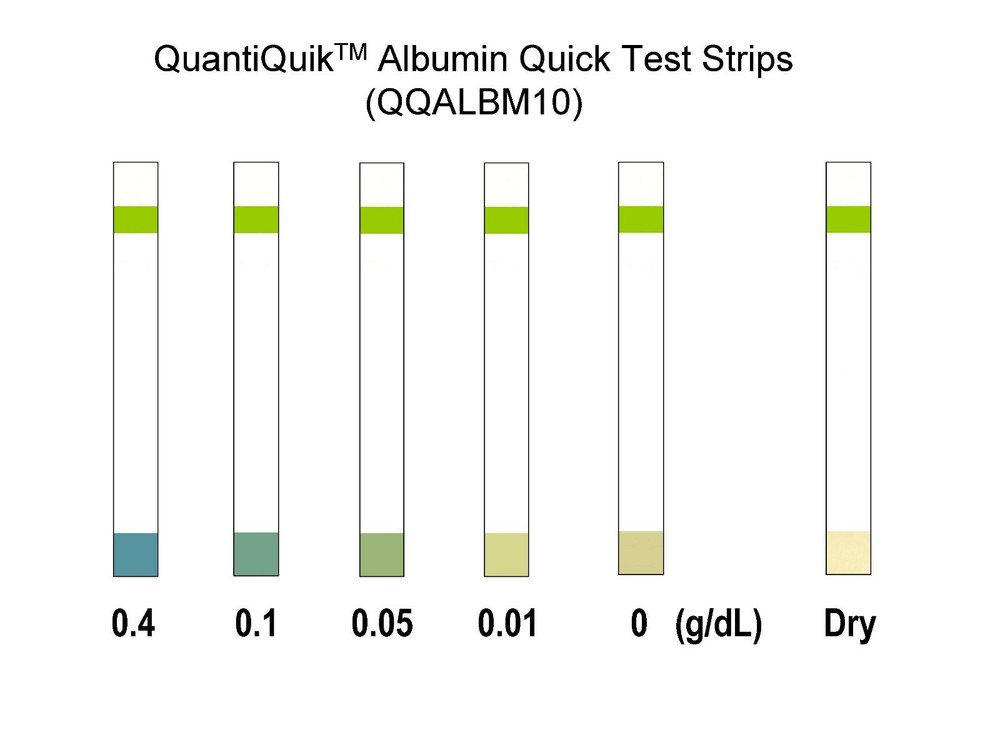 Albumin Quick Test Strips