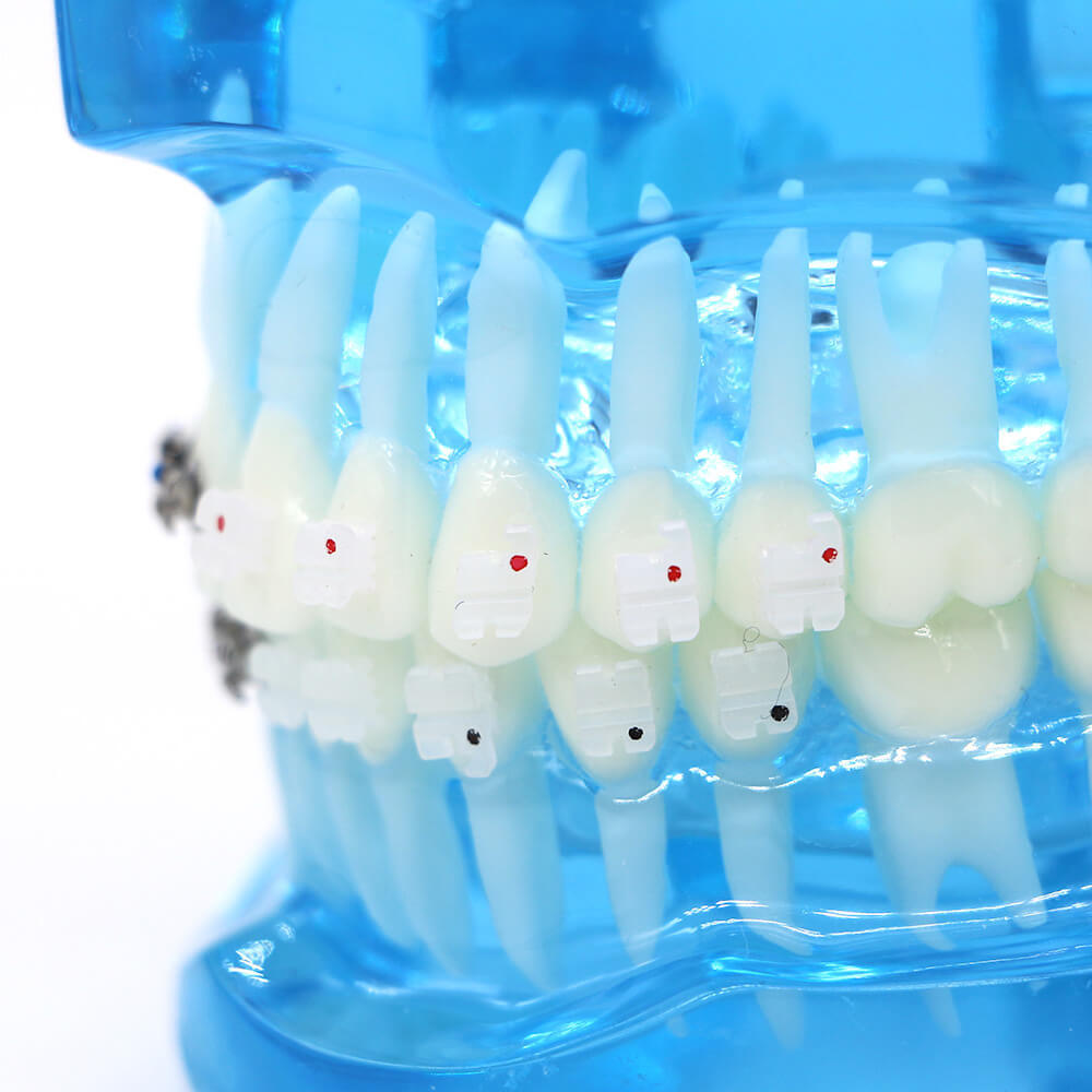 Dental orthodontic contrust teach study teeth model mental and ceramic bracket