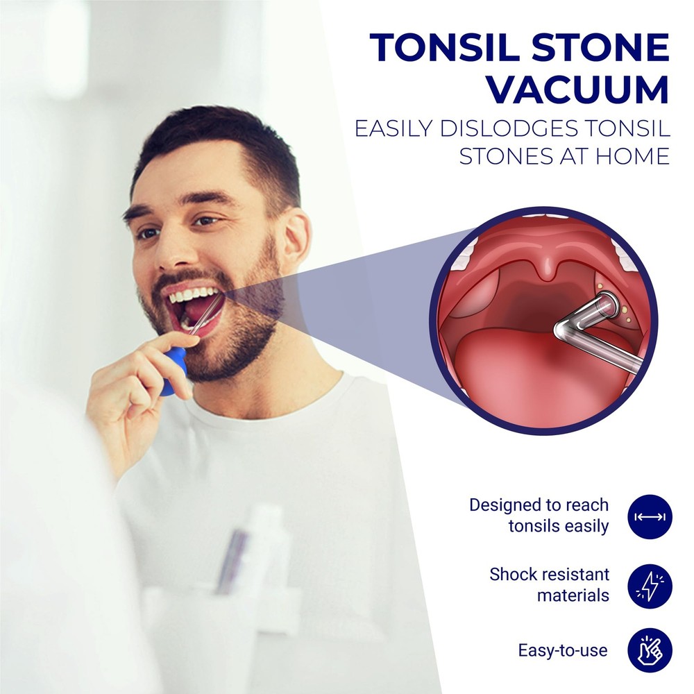 Oravix Tonsil Stone Vacuum, Remover Vacuum Suction, Tonsil...