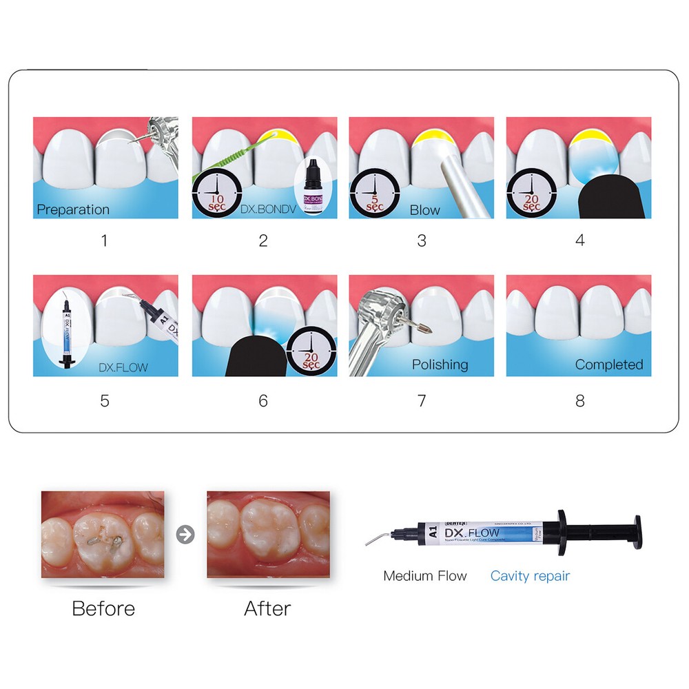 Dentex Dental Flowable Light Cure Composite Resin A1 Medium Flow