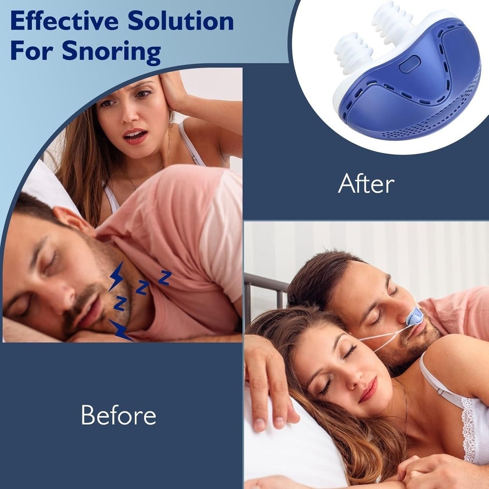 Double Vortex Anti Snoring Device, Adjustable Wind Speed Snoring Solution (Blue)