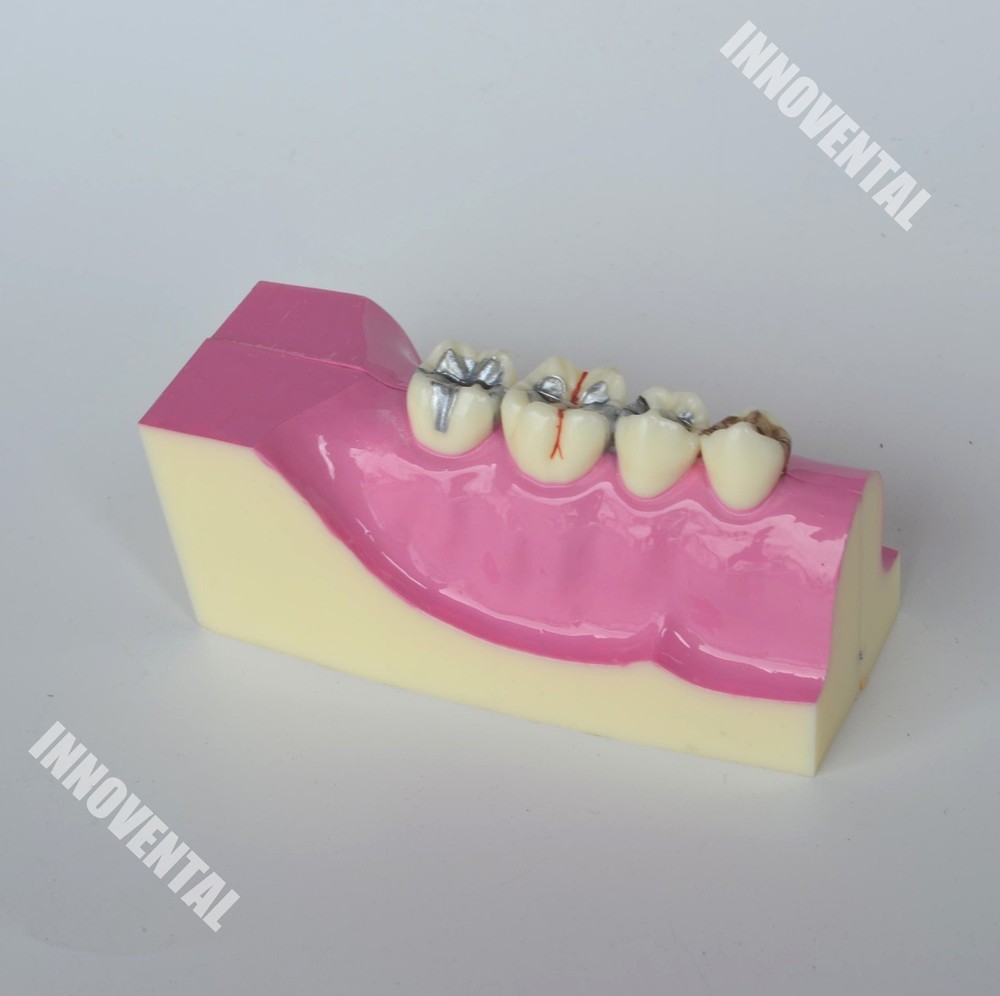 Dental Model #4009 01 - Cross-section Jaw Model