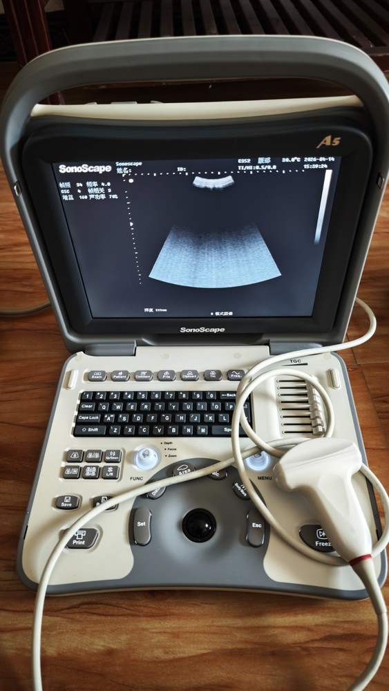 SonoScape A5 Portable Ultrasound