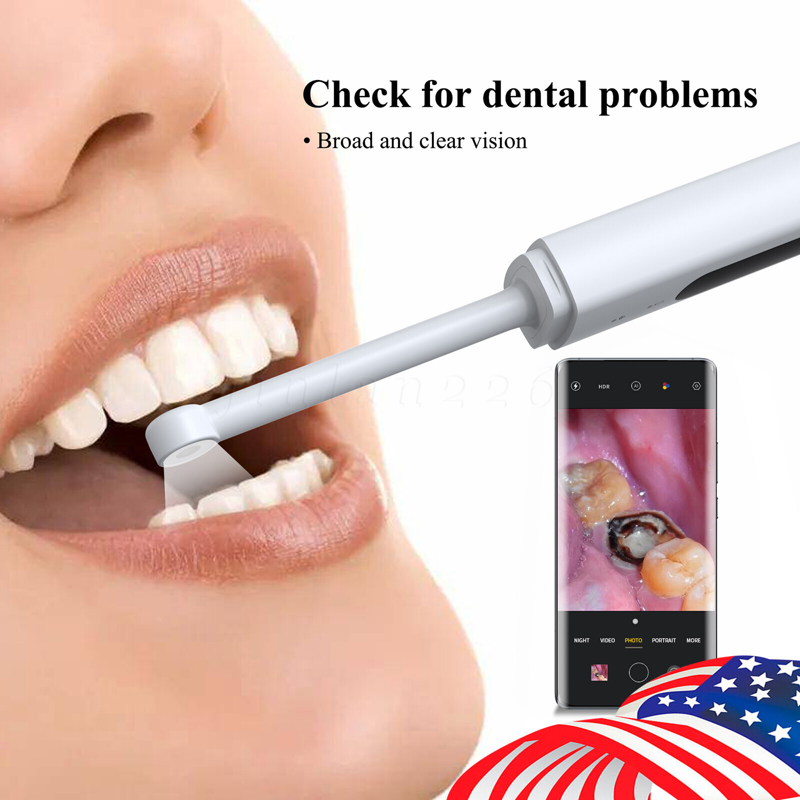 WiFi Dental Intraoral Camera Wireless 3.0 Mega Pixels HD Clear Image