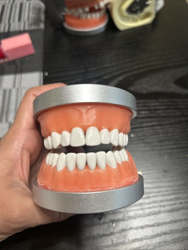 Acadental Optioned MP_R320