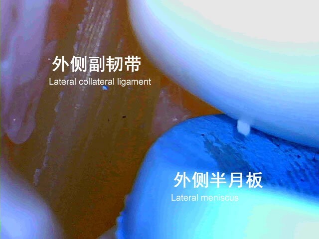 Knee Joint Model Arthroscopy Simulation Trainer Perfect for Medical Simulation