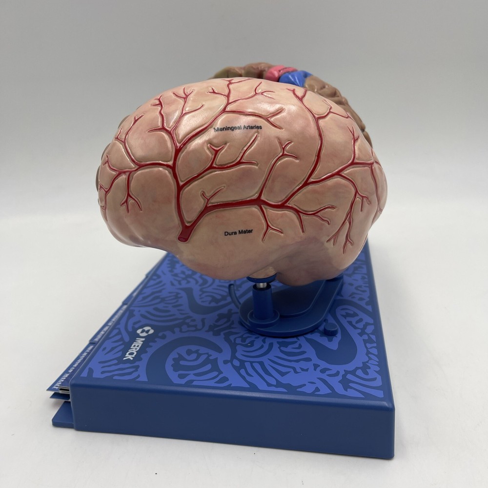 Maxalt Brain Anatomical Model Migraine Pathology Education Teaching Model