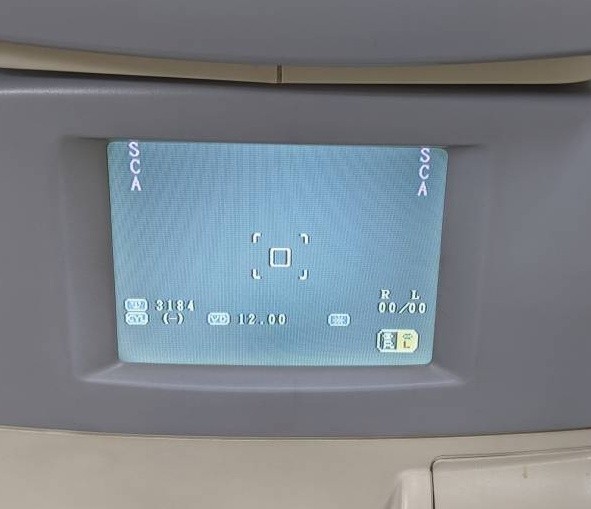 New For TOPCON RM-8800 KR-8800 Computer Optometry Machine Replace Display