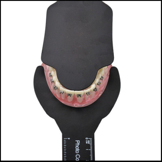 Dental Oral Photo Contrast Background Board Black Photographic Contraster 6 PCS