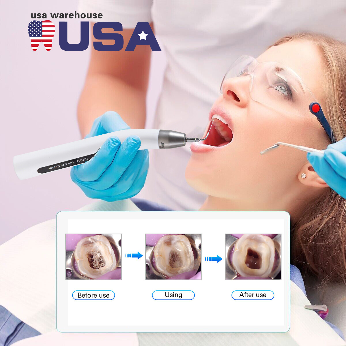 Dental Endo Ultra Activator Ultrasonic Irrigator Root Canal Scaling Handpiece