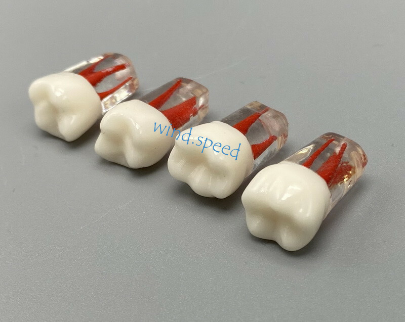 100pc Dental Root Canal Teeth Study Practice Model Endodontic RCT Endo Pulp File