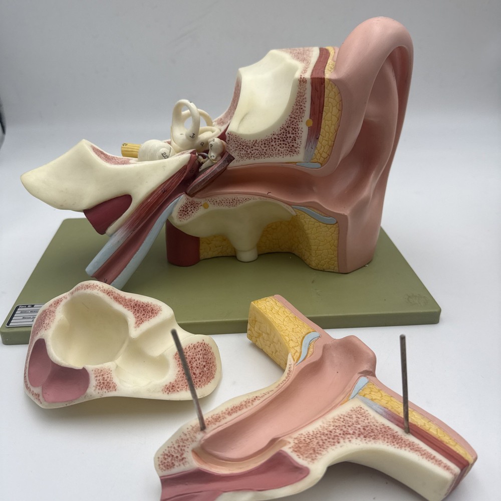 Somso DS5 Ear Anatomical Model - Hearing Inner Ear