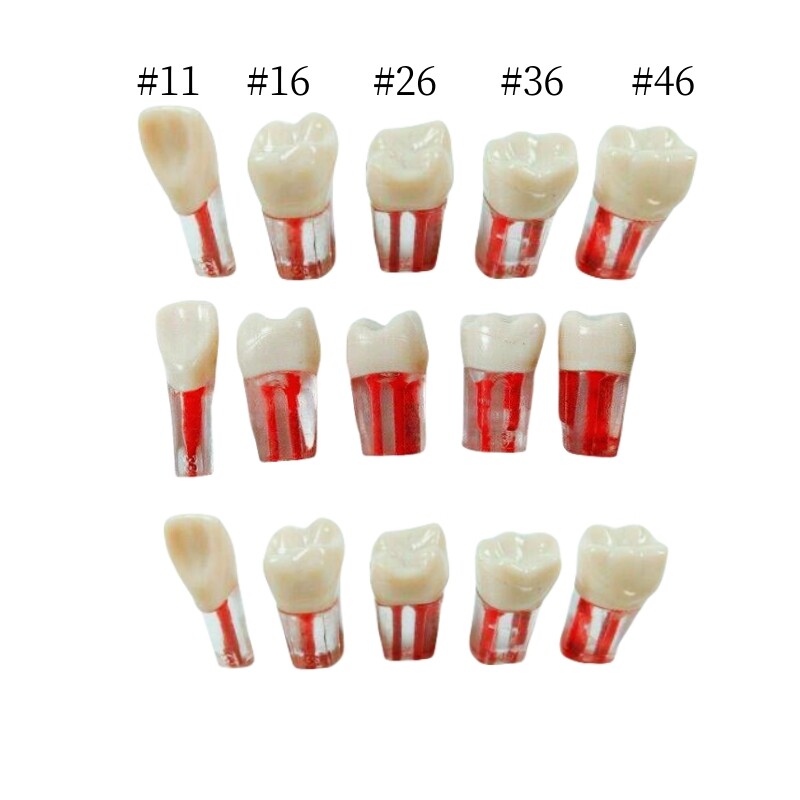 5pcs Dental Root Canal Teeth Study Practice Model for Endodontic Pulp File