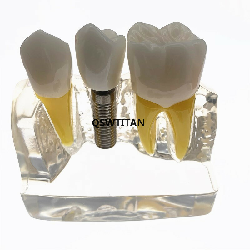 Dental Demonstration Study Teeth Model for Implant Analysis Crown Bridge Model