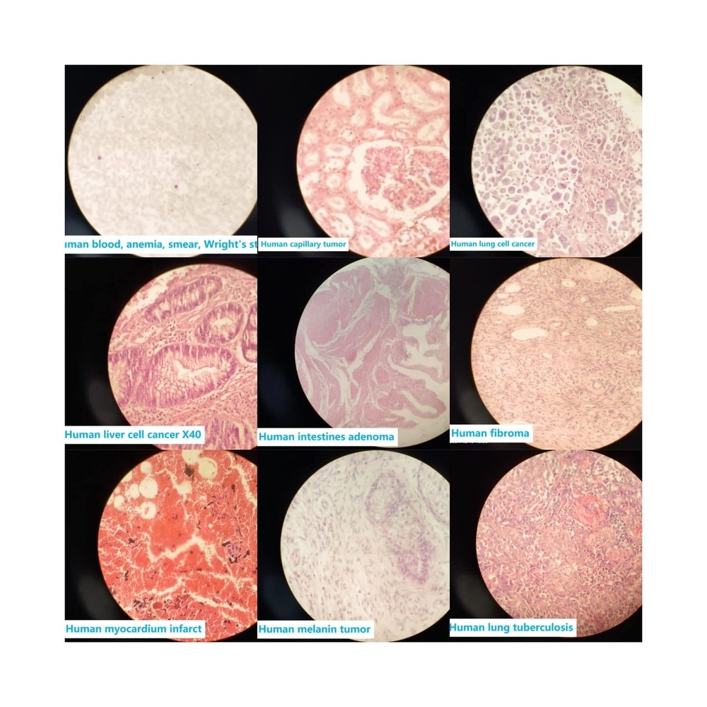 Prepared Human Pathology Microscope Slide Set, 12pcs Research-Quality Prepare...