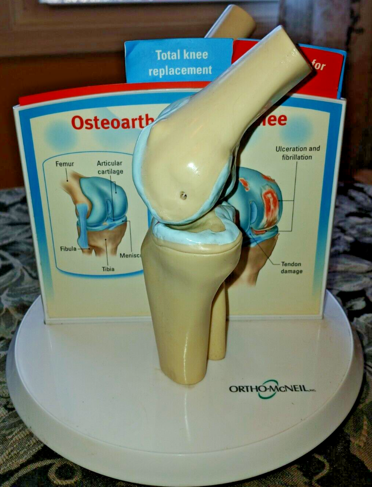 Anatstat ARTIFICIAL KNEE REPLACEMENT Medical Anatomical Skeleton DEMO MODEL