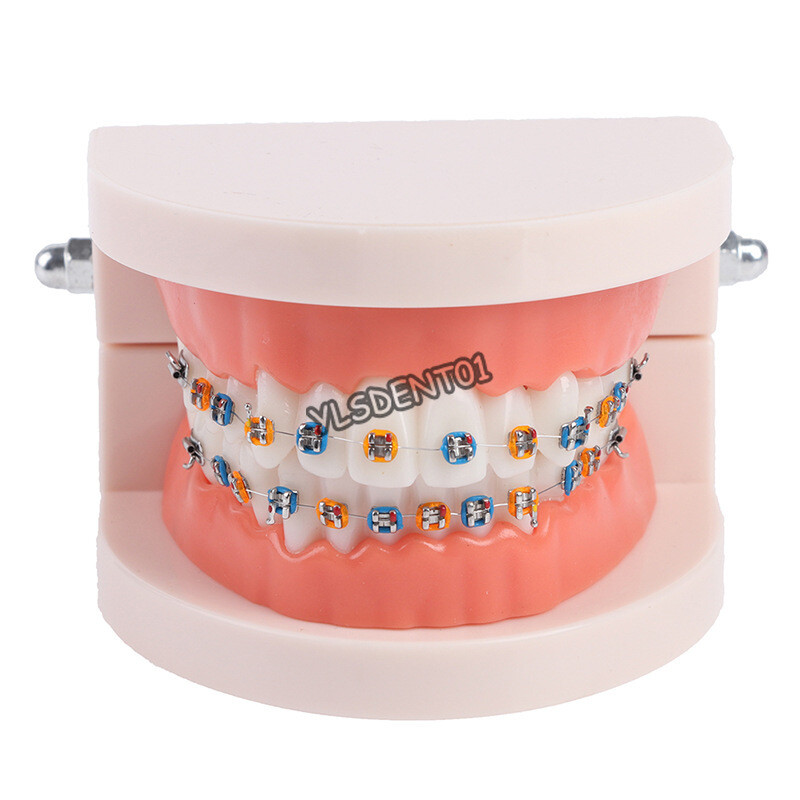 Dental Typodont Orthodontic Treatment Teeth Model Malocclusion Study w/ Bracket