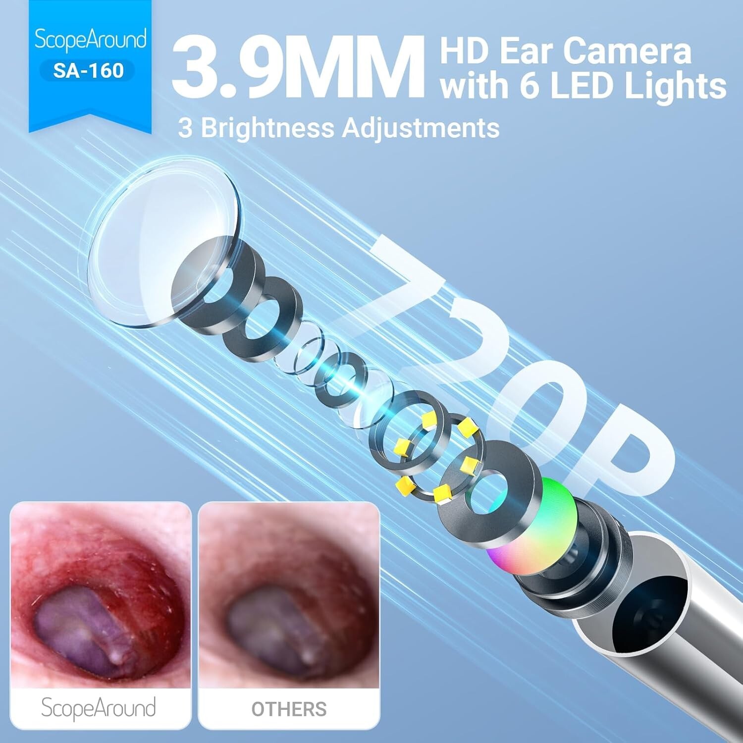 ScopeAround 3.9mm Ear Otoscope Camera with 1.45" IPS Screen Ear Wax Removal Tool
