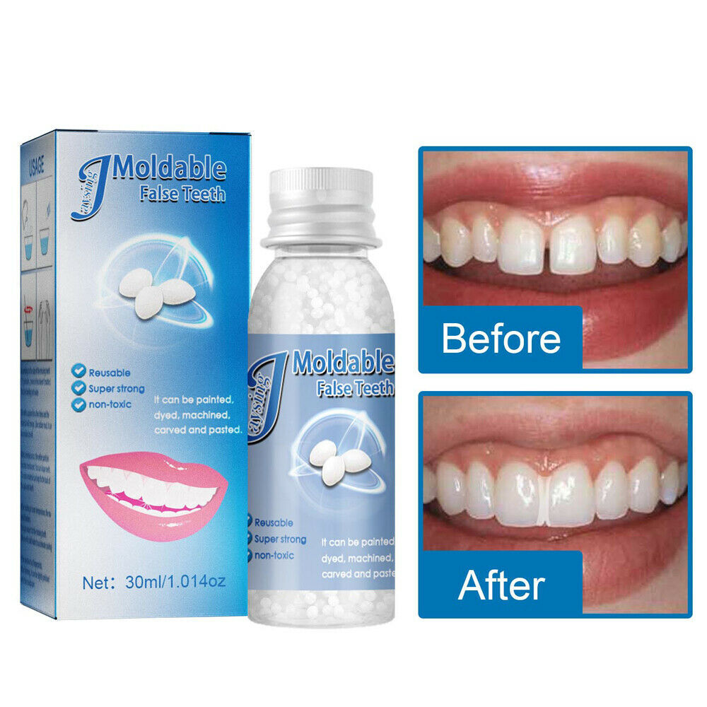 2x Resin False Teeth Solid Glue Temporary Tooth Gap Filler Tooth Repair Moldable