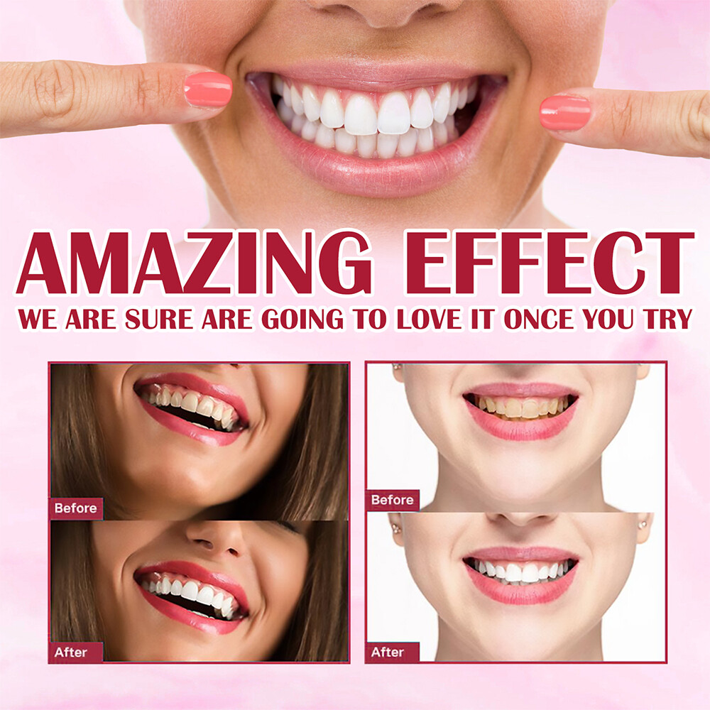 Sp-4 Probiotic Toothpaste for Whitening Bleaching Teeth Stain Removal Cleaning