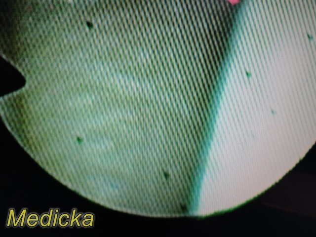 Olympus CHF-CB30S Fiber Optic Choledoscope Flex-Endoscope Read