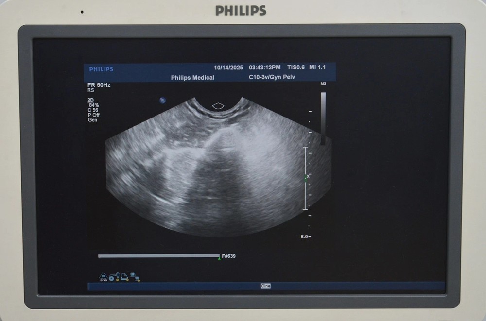 Philips iU22 System 8500-0064 W/ Philips C10-3v Broadband Curved Array