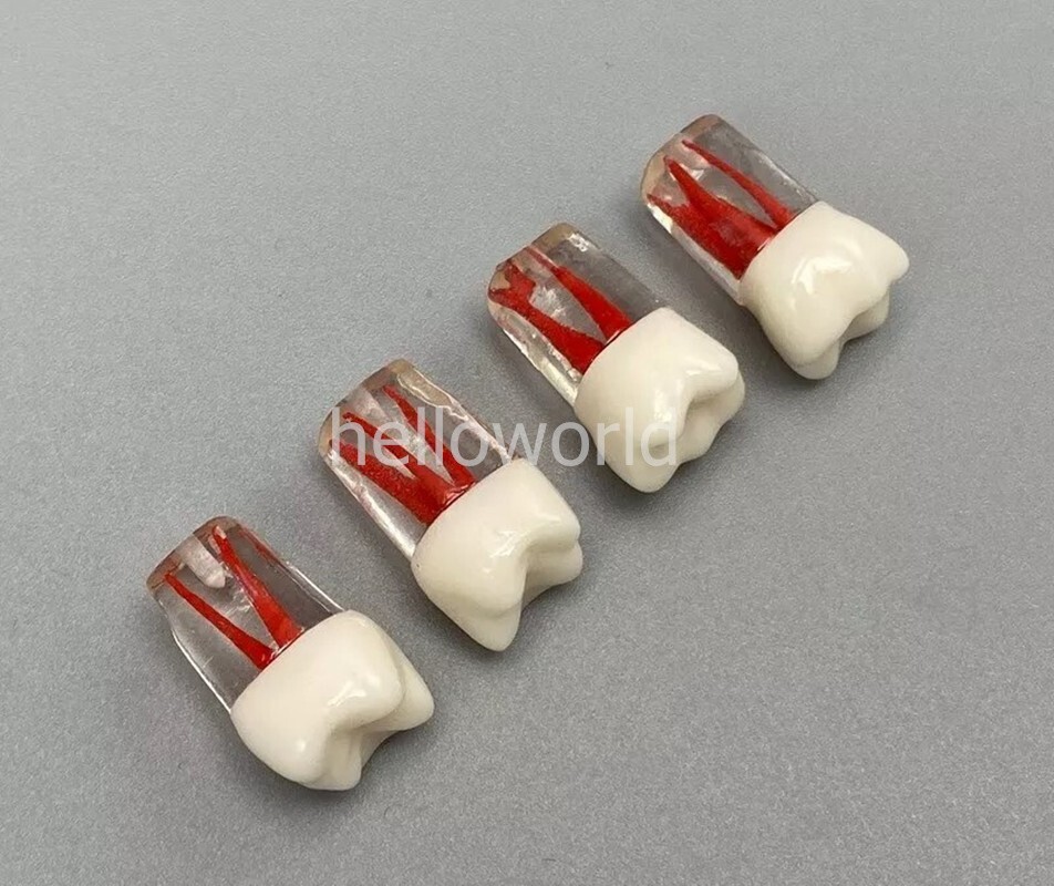 Dental Root Canal Teeth Study Practice Model Endodontic RCT Endo Pulp File 5pcs