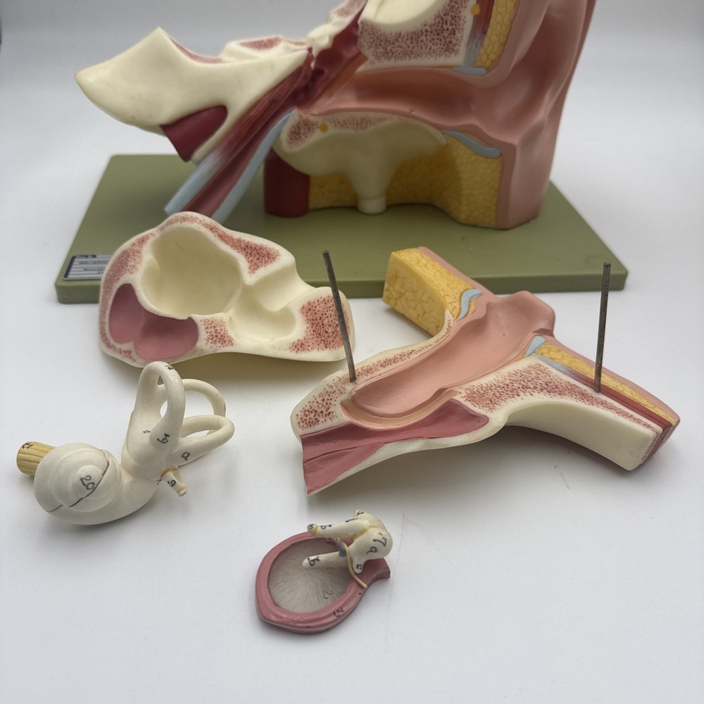 Somso DS5 Ear Anatomical Model - Hearing Inner Ear