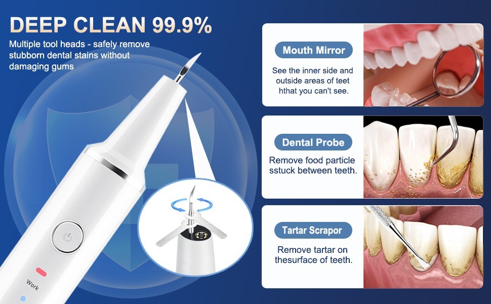 Electric Ultrasonic Dental Calculus Tooth Cleaner LED Scaler Plaque Remover Tool