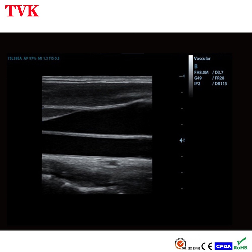 Mindray 7L4s Linear Array Probe Compatible Transducer M5, M6, M7, M7 Vet, TE5/7