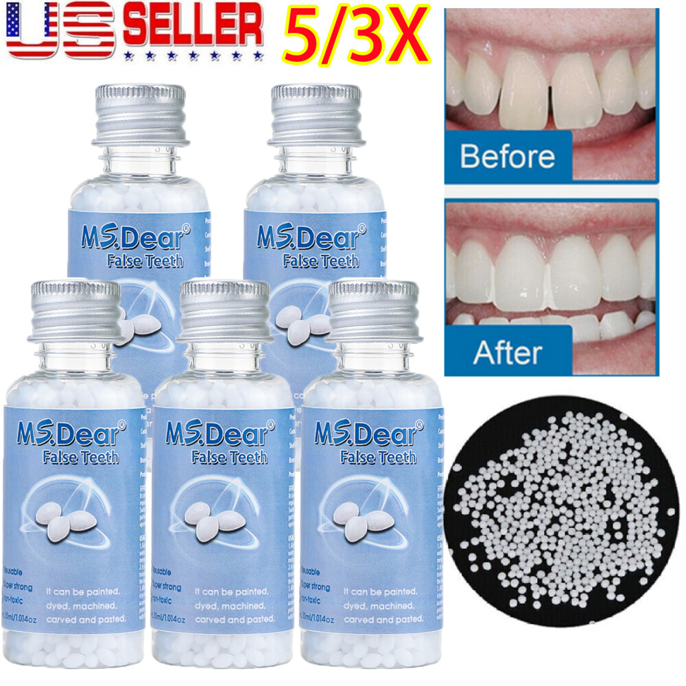 Tooth Solid Gel Temporary Moldable Repair Kit Thermal Fitting Bead Teeth 5x30ml