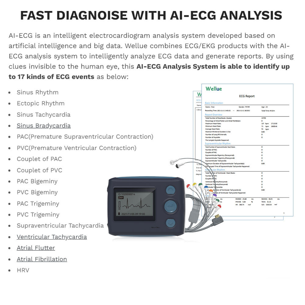 12 Lead Holter Monitor Recording 24h ECG and Heart Rate AI Analysis Abnormal ECG