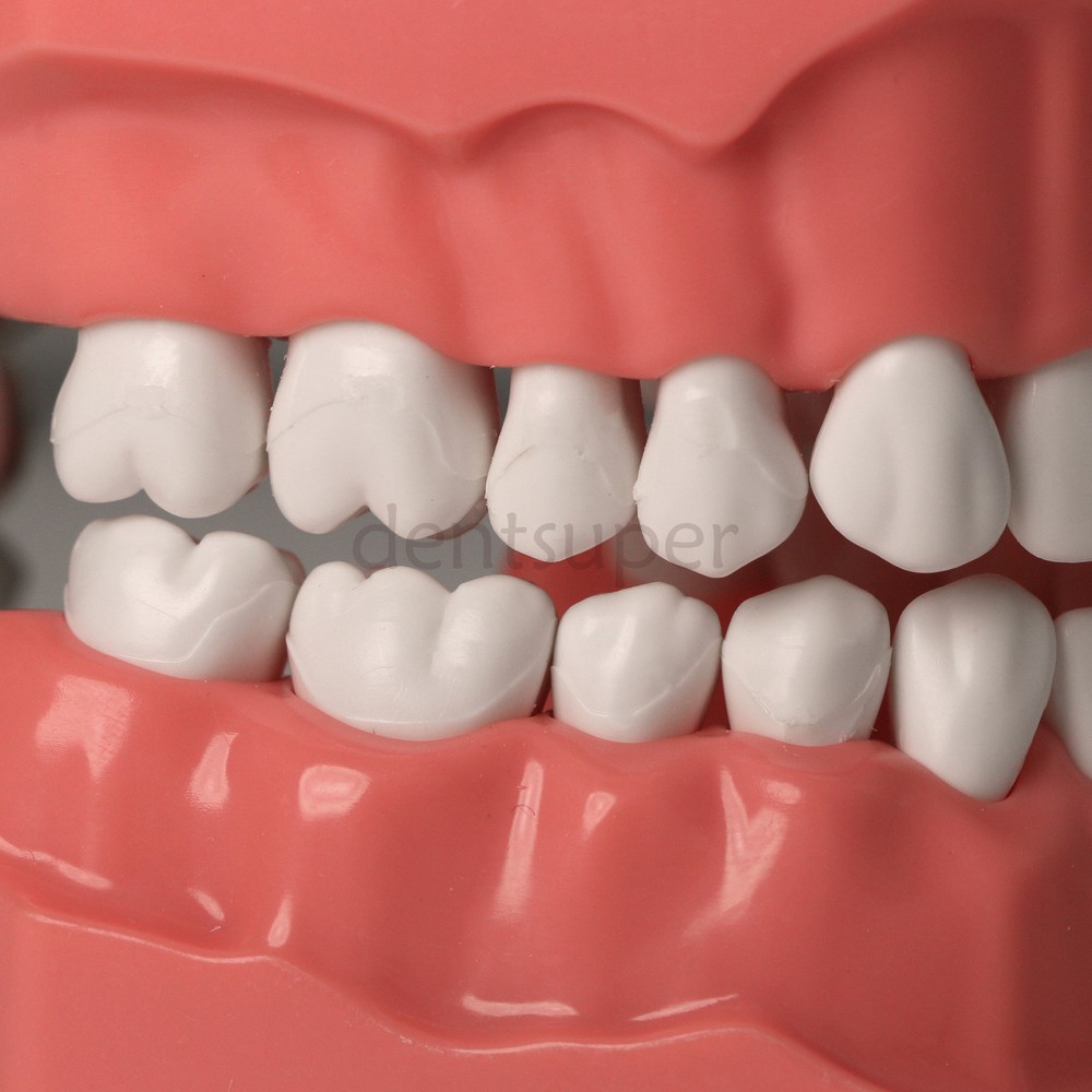 Dental Teach Study Typodont Teeth 1:1 Model With Metal Ceramic Brackets Tubes