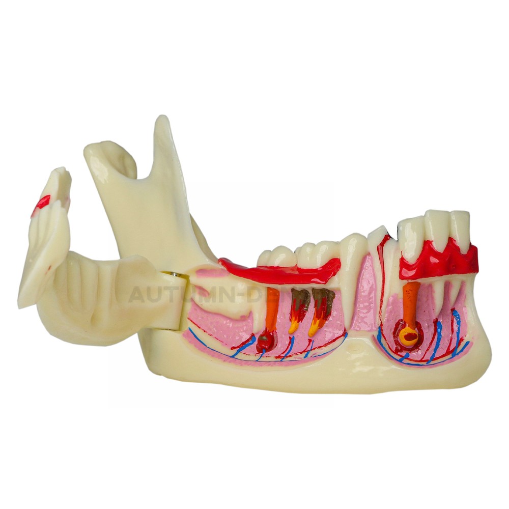 Dental Mandibular Tissue Teeth Anatomical Model Patient Teach Study Education
