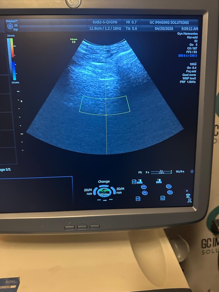 RAB2-5-D, GE Ultrasound probe