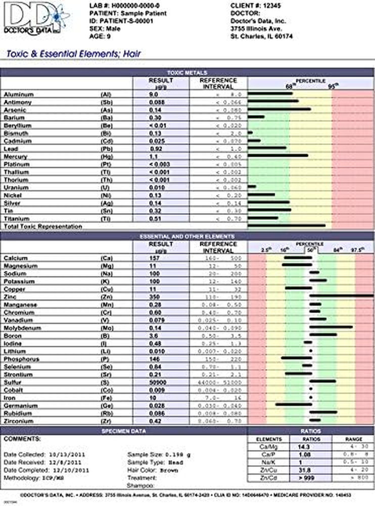 Essential Elements and Heavy Metals Toxicity Test (22 Elements and 17 Toxins)