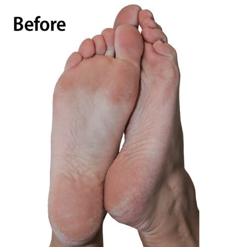 Emjoi Replacement Refill Rollers for Emjoi Micro-Pedi (Extra Coarse) *Genuine*