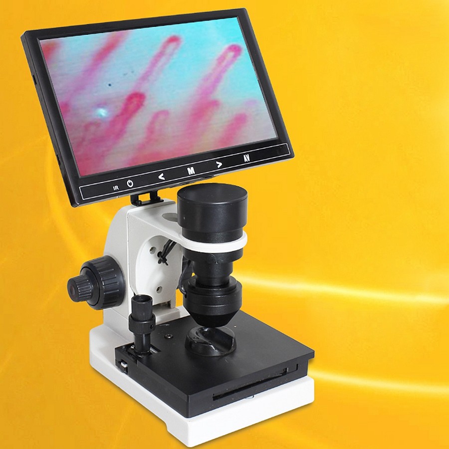 Digital Microscope Terminal Microcirculation Detection Nail Wall Observe Screen