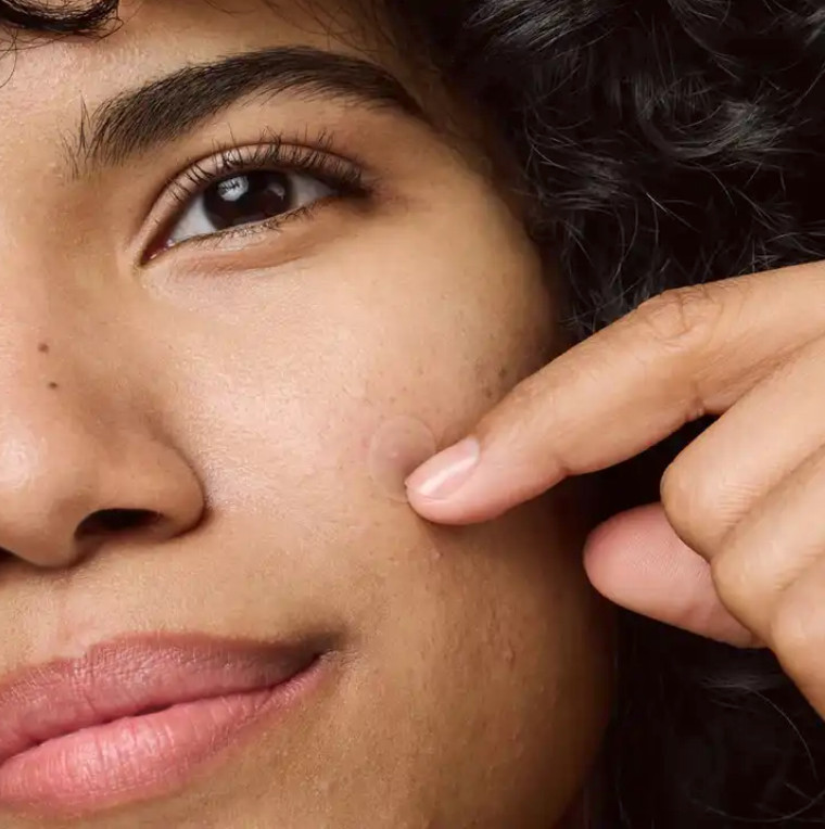 Hollywood Look Acne Patch