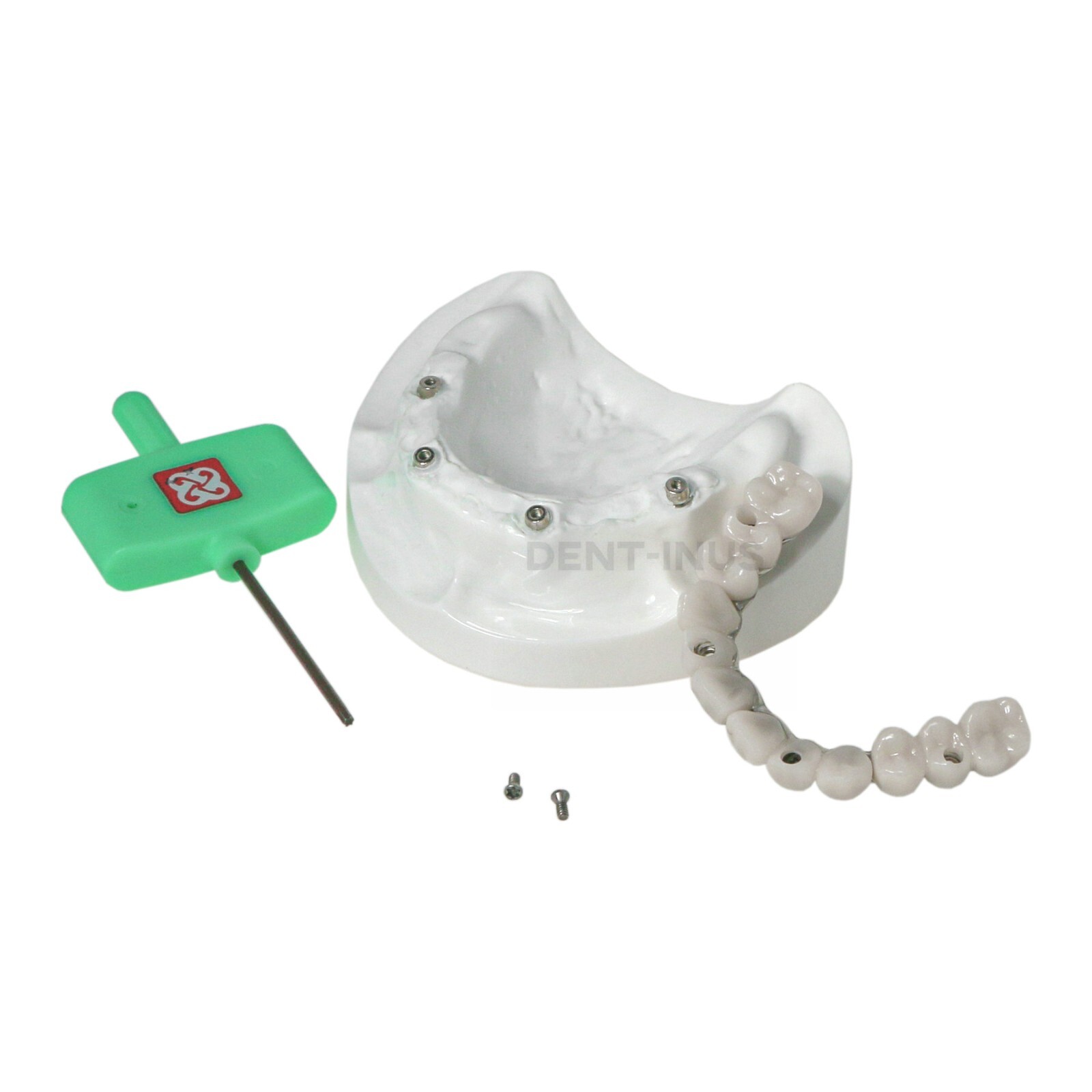 Dental Implant Typodont Teeth Restoration Model Series Overdenture Practice Demo